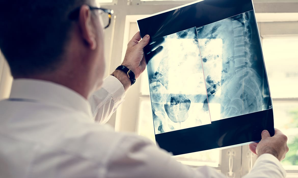 Radiología en Huechuraba