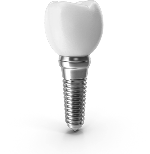 Implante dental en Salud Nacional